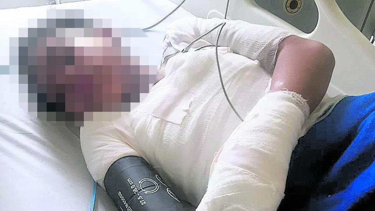 agresor de niña atacada en Suba tenía dos condenas vigentes y orden de captura y hoy está privado de la libertad