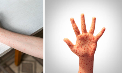 Secretaria de Salud activa protocolos