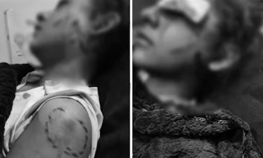 Menor fue brutalmente atacada en estación de gasolina en el norte de Bogotá: fue mordida y apuñalada en un ojo