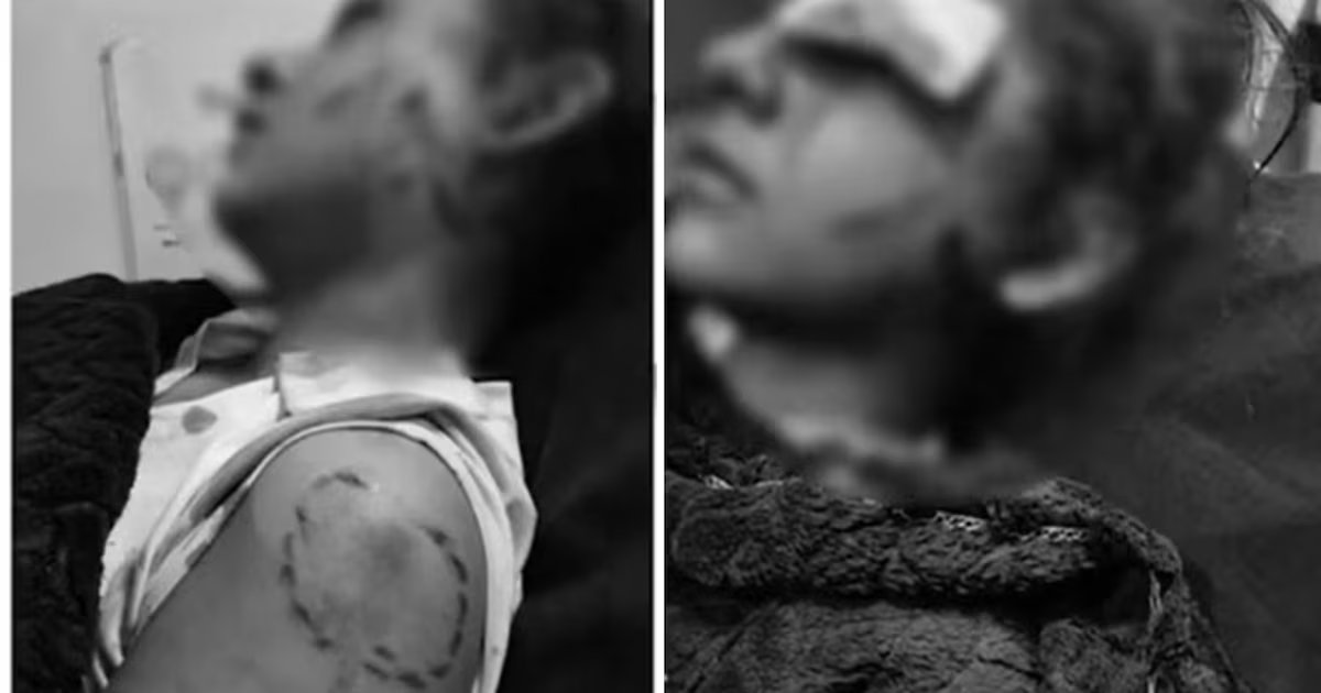 Menor fue brutalmente atacada en estación de gasolina en el norte de Bogotá: fue mordida y apuñalada en un ojo