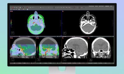Studio Display XDR de Apple admite imágenes médicas DICOM para radiología de diagnóstico