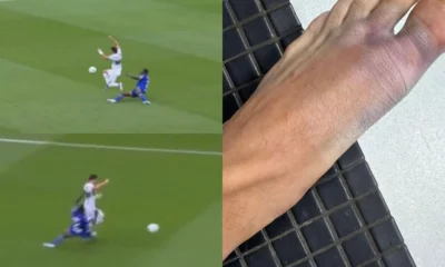 lesión Germán Valera — Lesión Germán Valera: Elche y Getafe frente a la controversia por la roja a Djen