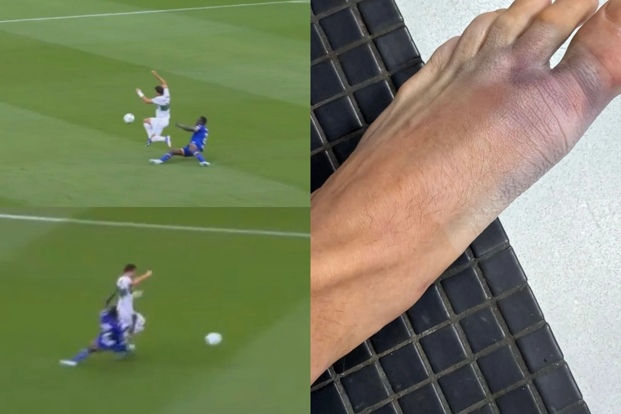 lesión Germán Valera — Lesión Germán Valera: Elche y Getafe frente a la controversia por la roja a Djen